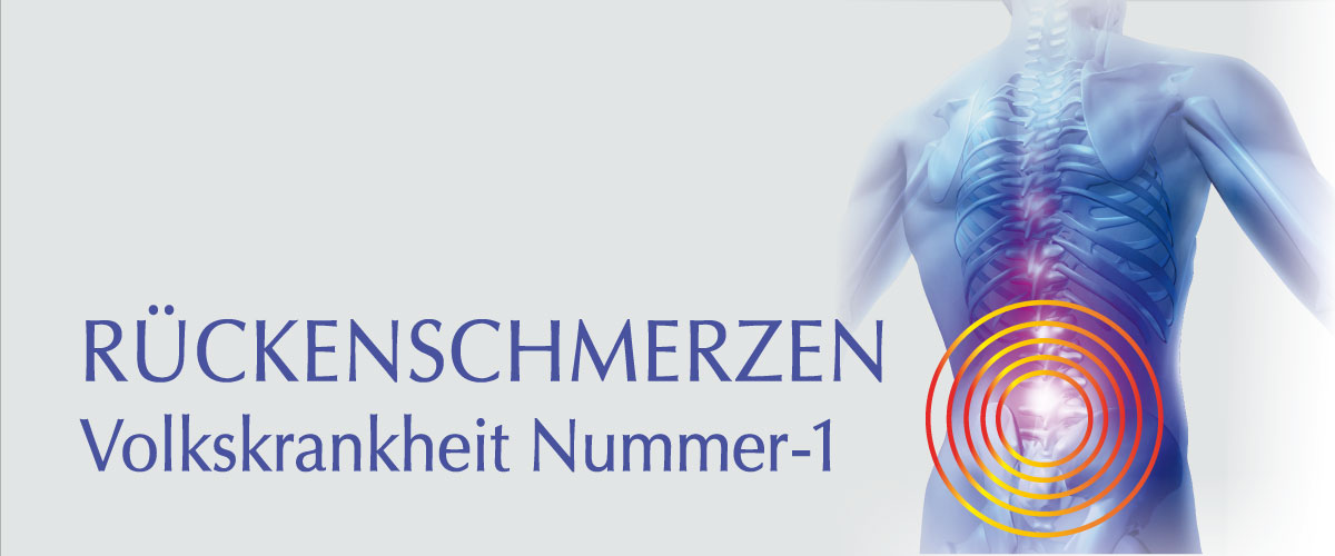 Rückenschmerzen